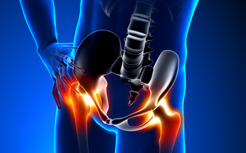 hip dysplasia