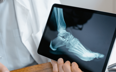 5 Signs You Need to See an Orthopedic Specialist in South Carolina
