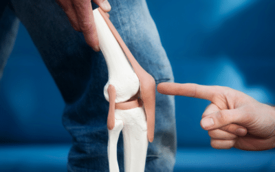 10 Questions to Ask Your Orthopedist Before Getting a Knee Replacement