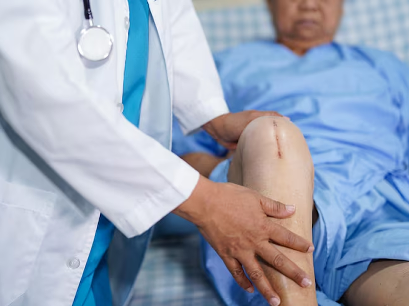 Why Choose CONA for Hand and Wrist Care 15