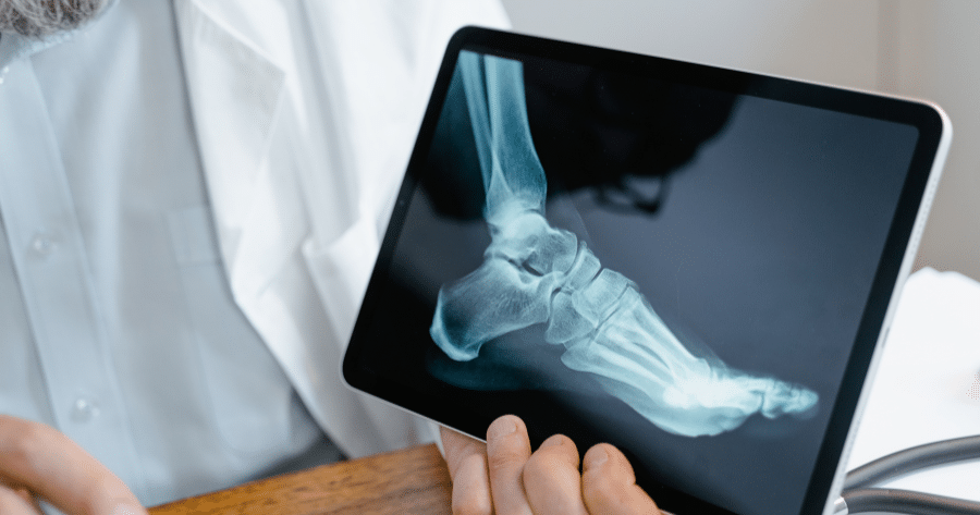 5 Signs You Need to See an Orthopedic Specialist in South Carolina